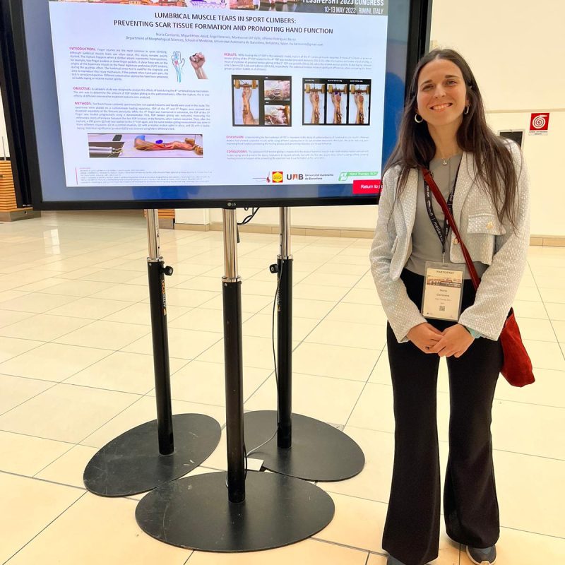 Maig 2023, Presentació al Congrés Europeu cirurgia i teràpia de mà a Rimini, Itàlia