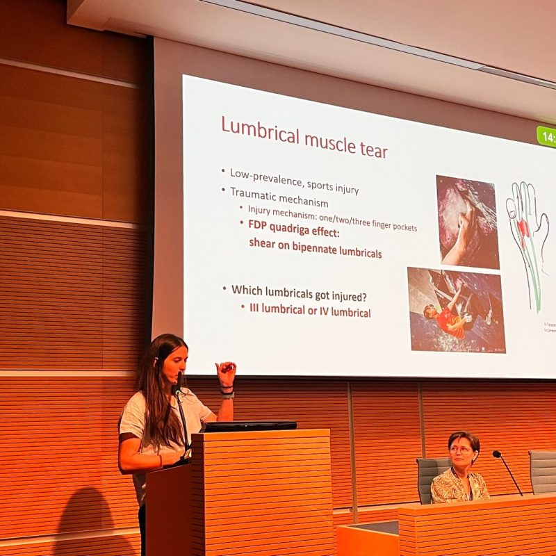 Maig 2023, una altra ponència al Congrés Europeu cirurgia i teràpia de mà a Rimini, Itàlia